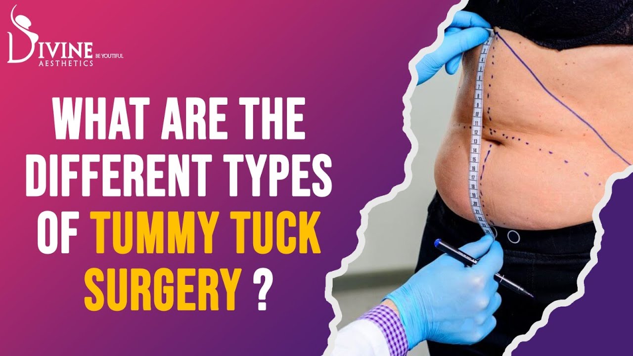 Latest 2023 Top Tummy Tuck Trends - Practices in Plastic Surgery