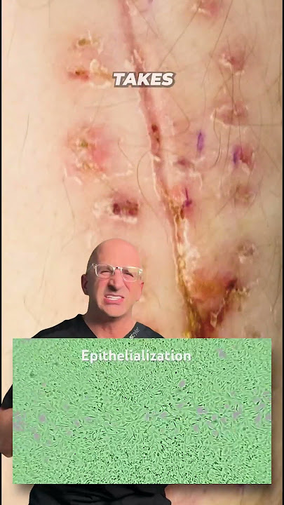 Do Covered Incisions Heal Faster? #shorts