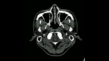 HorliX can export DICOM to movie  file (.mov)