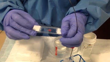 Video 2 On site specimen handling EUS FNA