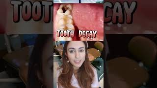 Top Causes Of Bad Breath! 🤢 #shorts