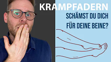 Was ist das beste Mittel gegen Krampfadern?