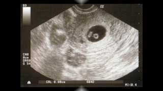 Pregnancy slideshow