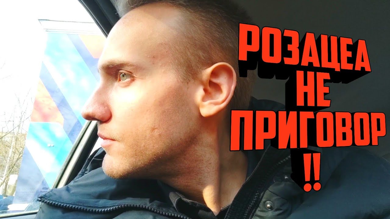 Как ВЫЛЕЧИТЬ РОЗАЦЕА? Как ИЗБАВИТЬСЯ от ПРЫЩЕЙ на лице? Розацеа на лице ...