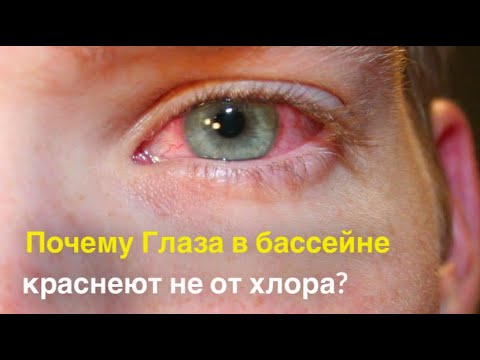 Почему Глаза в бассейне краснеют не от хлора? факты о бассейне