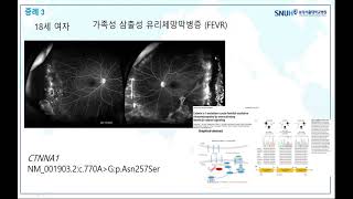 (한국망막변성협회) 유전성 망막질환에서의 정밀의료 (Precision medicine for inherited retinal diseases)