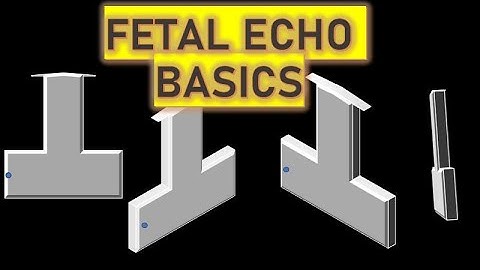 Fetal ECHO Part 1 || Basics explained || With probe positions