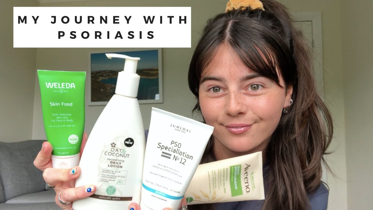 MY JOURNEY WITH PSORIASIS - YouTube