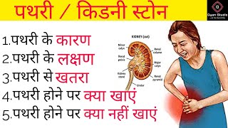 किडनी स्टोन कैसे होता है,kidney stone kaise hota hai,kidney stone ke karan,kidney stone ke symptoms