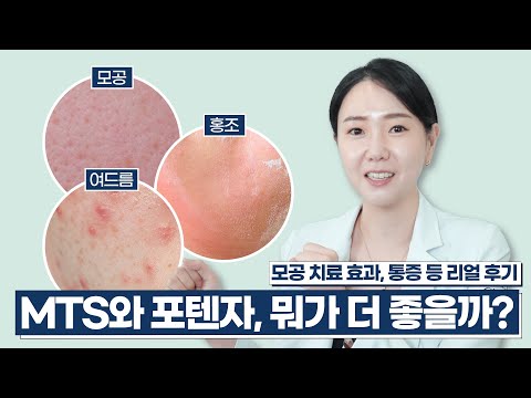 요즘 난리난 모공치료, 포텐자! 직접 보여드릴게요 | MTS 시술과 비교, 추천 꿀조합