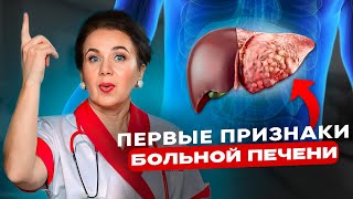 Очистите печень БЕЗ ТАБЛЕТОК! Как улучшить отток желчи и спасти желчный пузырь?