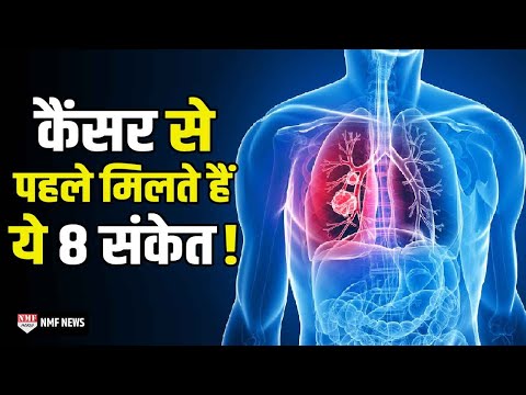 वीडियो: कौन सा ब्रैडेन स्कोर खतरे में है?