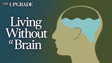 The Man Who Lived Without a Brain