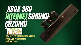 XBOX 360 İnternet Bağlantı Sorunu Çözümü I XBOX Live Bağlantı Sorunu Nasıl Çözülür ?