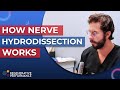 How Nerve Hydrodissection Works