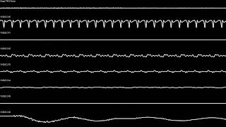 INTRODUCTION - Tecmo Cup Football Game // Megadrive Oscilloscope view