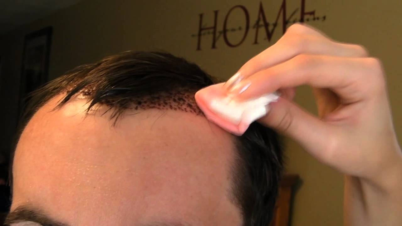 Faqs Kosmedix Global Aesthetic Institute