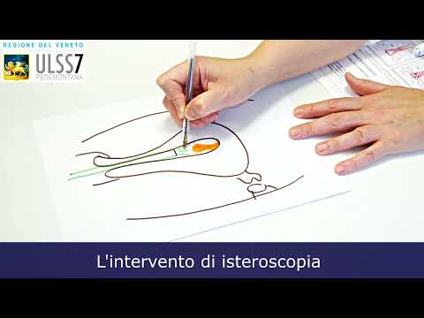 intervento-di-isteroscopia