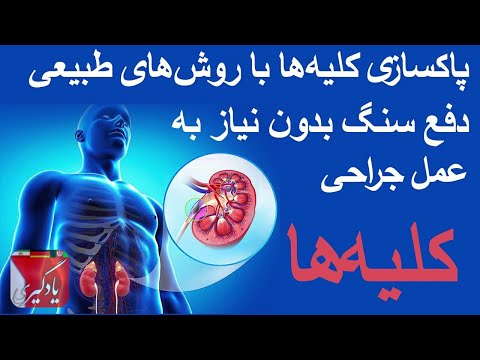 تصویری: نحوه تقسیم کلیه بدهی ها