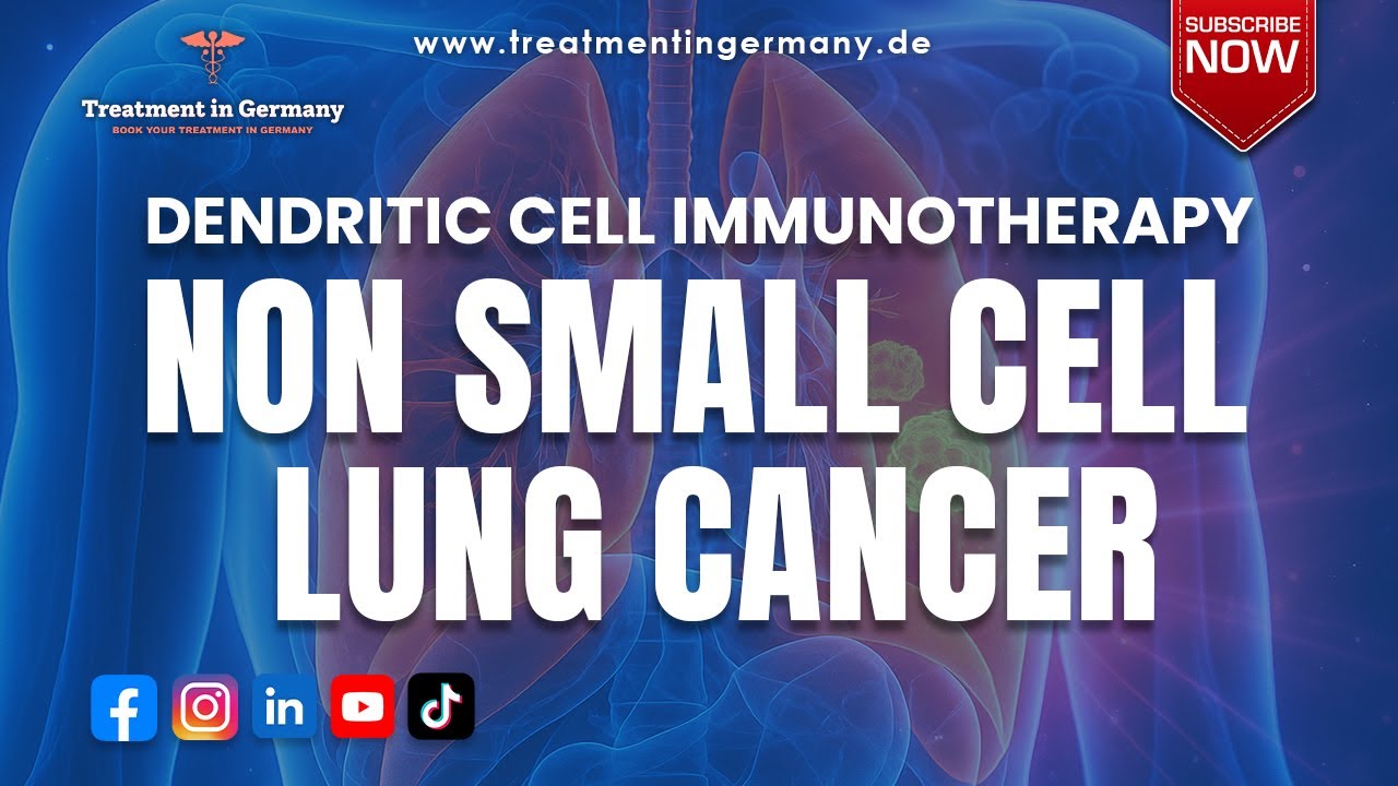 Advanced Dendritic Cell Immunotherapy for Non Small Cell Lung Cancer in Germany🫁🧬💉