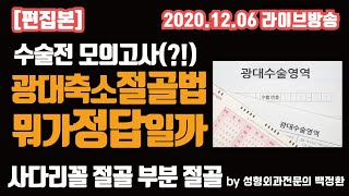 [편집본] 광대축소 절골법 뭐가 정답일까? [2020년 12월 6일 라이브]