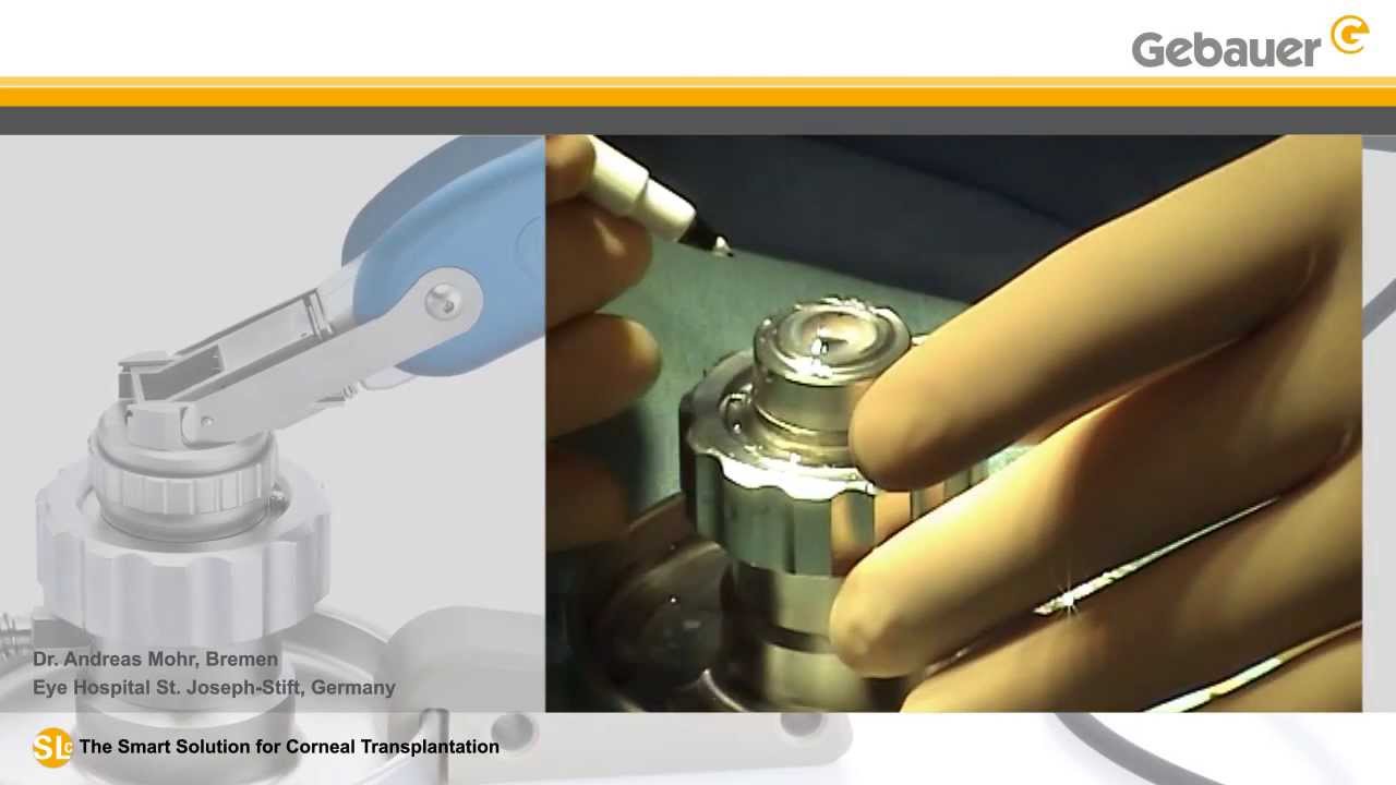 Preparation of donor tissue with 