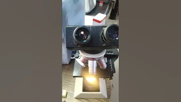 Semen Analysis Microscopic Examination Sperms Count Sperm Cell श क र ण पर क षण 