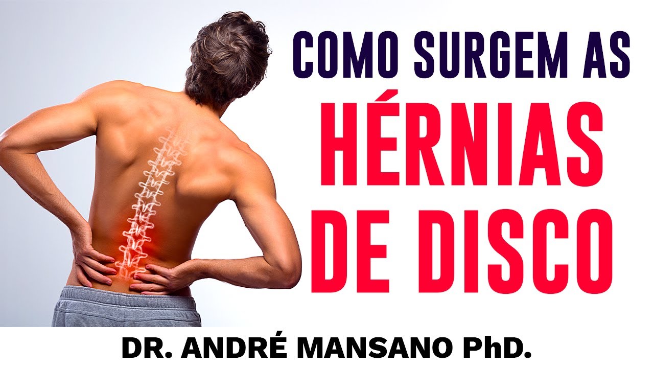 Como Surgem as Hérnias de Disco? – Dr. André Mansano Tratamento da