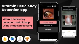 Vitamin Deficiency Detection Android App using Image Processing (𝐏𝐀𝐈𝐃 𝐀𝐏𝐏) || Android Project screenshot 2