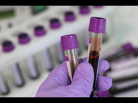 Videó: Ki határozza meg a laboratóriumi vizsgálatok szabványait?