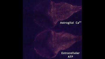 Simultaneous recordings of intracellular calcium in astrocytes and extracellular ATP