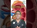 3 Tips to prevent Kidney stones | சிறுநீரக கற்கள் - தவிர்க்க வேண்டிய உணவுகள் | Kidney stones pain