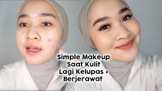 NO CUT NO EDIT  Simple Makeup on Acne prone skin (kulit berjerawat + kelupas) | Kiara Leswara