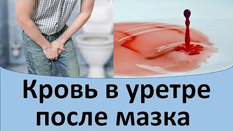 Кровь в уретре после мазка