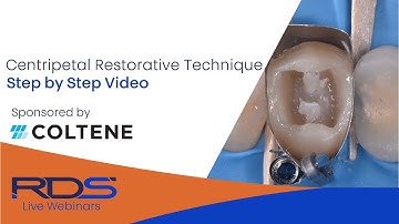 Centripetal technique. Step by step (pre-clinical demo)