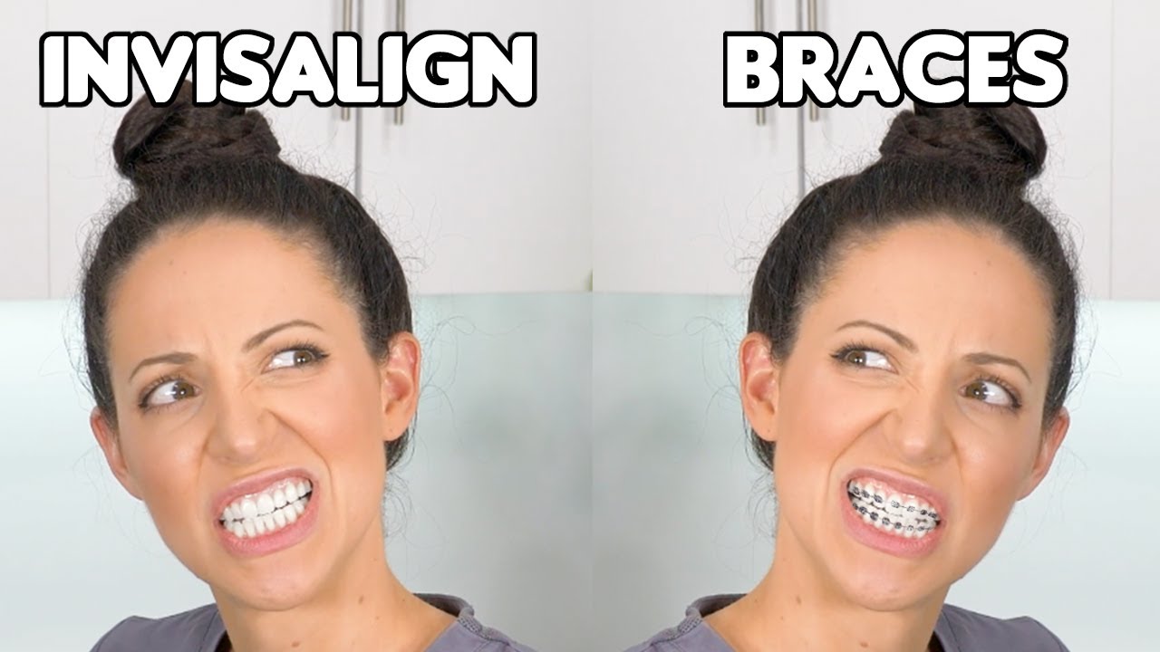 Braces or Invisalign? (Which is BETTER) 