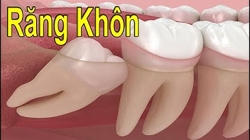 Răng Khôn Là Gì? Có Nên Nhổ Không? | Giải Thích Chi Tiết Từ Bác Sĩ Nha Khoa