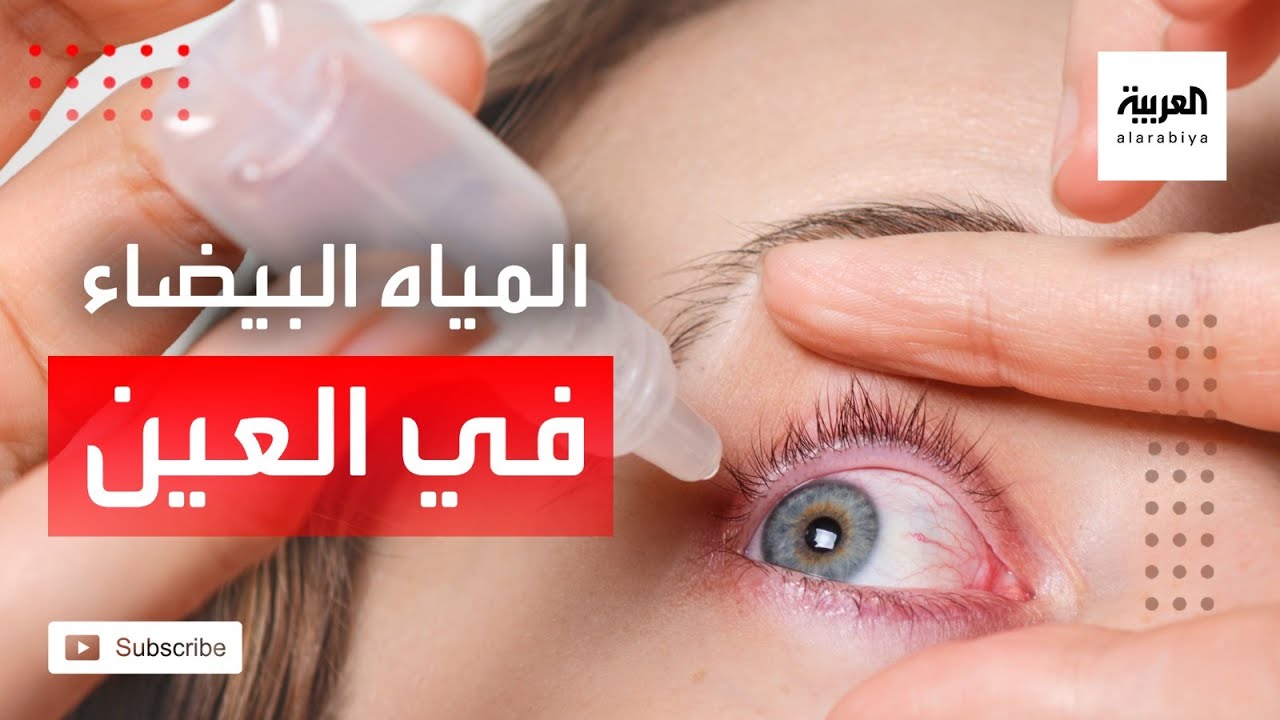 صباح العربية | المياه البيضاء تغييرٌ طبيعيٌ في العين ويؤثرُ تدريجيا على الرؤية
