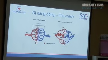 Siêu âm Doppler động mạch chi dưới và các bệnh thường gặp, Thầy Nguyễn Ngọc Cương
