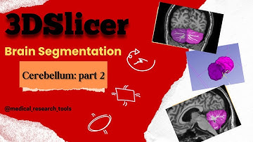 🧠Brain Segmentation with 3D Slicer: Cerebellum (part 2)