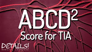 ABCD2 Score for Transient Ischemic Attack (TIA) | Details
