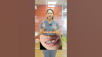 Niềng Mắc Cài Không Nên Ăn Gì? Find Out Now!