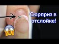 Снятие Гель-лака с Отслойками, Как сделать форму миндаль?