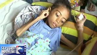Gizi Buruk 9 Tahun Berat Badan Hanya 11 Kg sindo Sore 21 Nov 2015