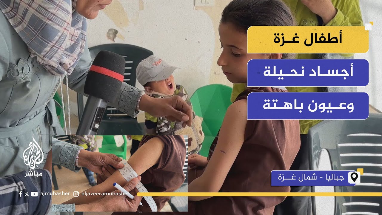 أجساد نحيلة وعيون باهتة..تدهور أوضاع الأطفال بشكل يومي، وسط غياب أي استجابة إنسانية