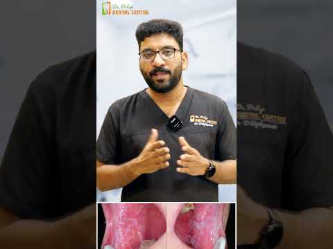 Understanding Oral Lichen Planus : Symptoms, Causes, and Care with Dr. Dilip Kumar