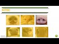 Comparative Anatomy of the Respiratory System in Mammals and Birds