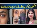 Aankhon Ke Halke Dur Karne Ka Tarika - Dark Circles Ka ilaj - Dark Circles Treatment at Home