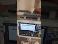 Okuman DFM 300 Defibrilatör Kullanıcı Testi, Yoğun Bakım