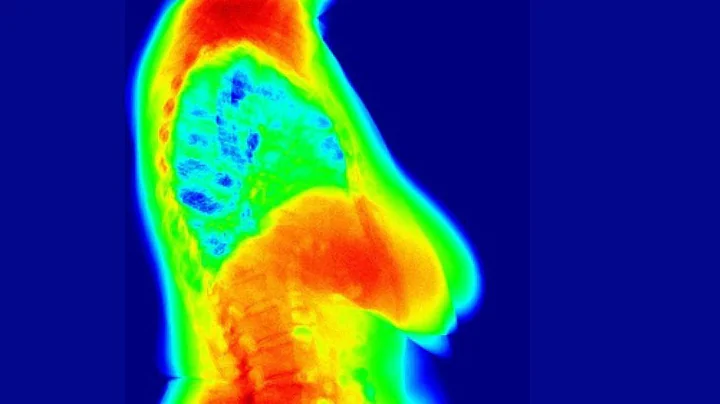 Thermal Imaging [Part 2] Breast Health with Dr. Pa...